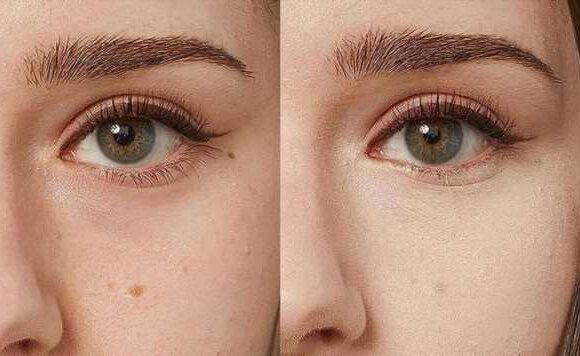 Beauty lovers rave about Amazon concealer for ‘a flawless look’