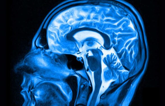 Being overweight 'can swell part of the brain and send hunger pangs spiralling out of control' | The Sun