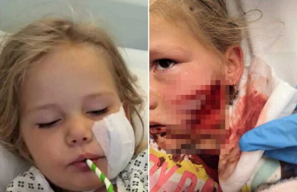 Dad reveals horrifying moment five-year-old daughter’s face ‘ripped off’ by American Bully outside Nisa shop | The Sun