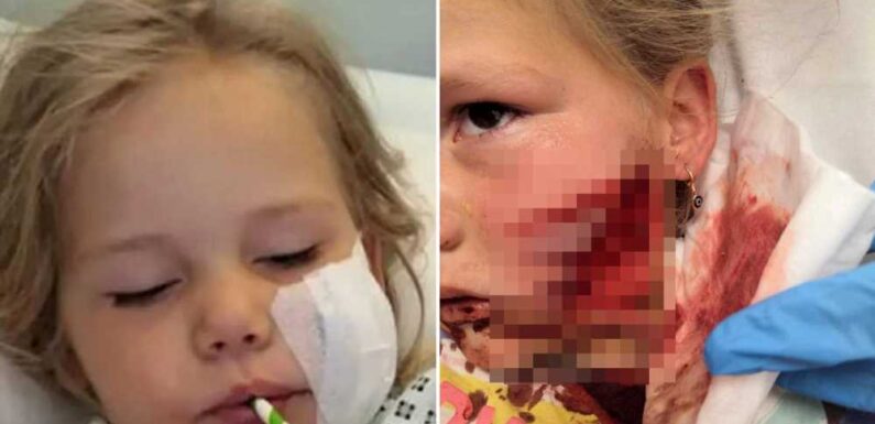 Dad reveals horrifying moment five-year-old daughter’s face ‘ripped off’ by American Bully outside Nisa shop | The Sun
