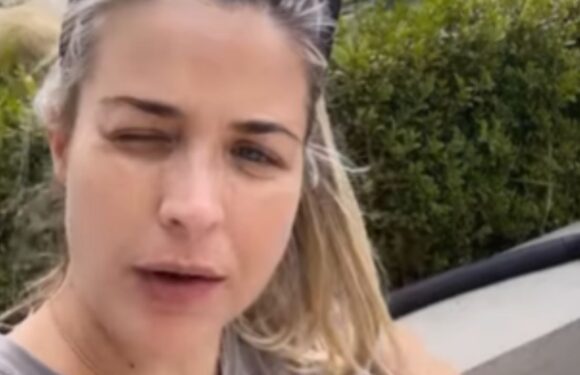 Gemma Atkinson gets tough reminder she needs to slow down