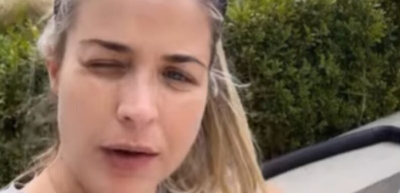 Gemma Atkinson gets tough reminder she needs to slow down