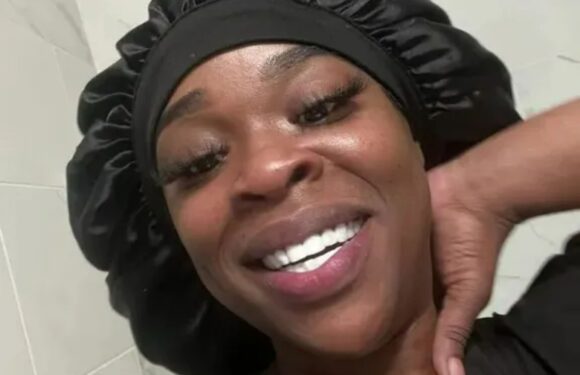 I gave myself DIY Turkey teeth – I’m no dentist and it was a bit nasty, but they look absolutely fantastic | The Sun