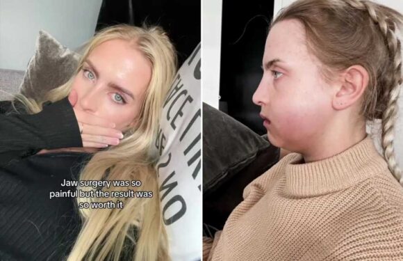 I had pricey jaw surgery – it was super painful but at least I don't look like a Family Guy character anymore | The Sun