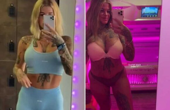 I shed 14st after having weight loss surgery but now I’m desperate to pile on the pounds – trolls say I’m mad | The Sun