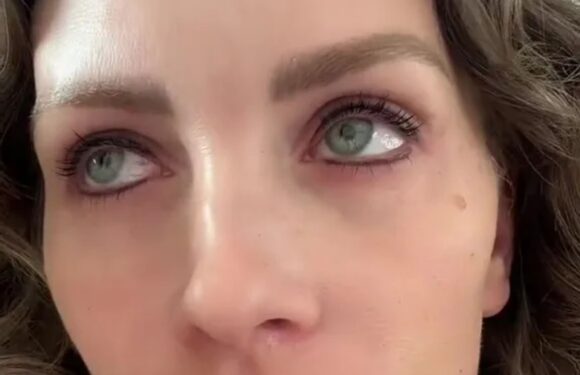 I was 20 & thought it would be a good idea to get eyeliner permanently tattooed…17 years later, I still really regret it | The Sun