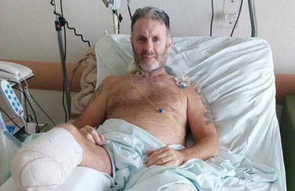 I was crushed by a drunk driver in Spain – I saw bits of my smashed bones on the road & I’m facing a two year battle | The Sun