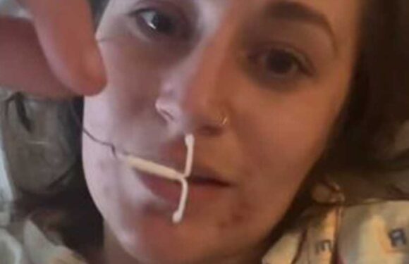 I was so sick of being in agony while on the coil so pulled it out myself, I couldn't wait til my doctor's appointment | The Sun