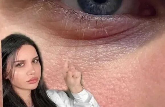 I’m a skincare fan and my under eye wrinkles and dark circles have ‘never looked better’ thanks to a £20 product | The Sun