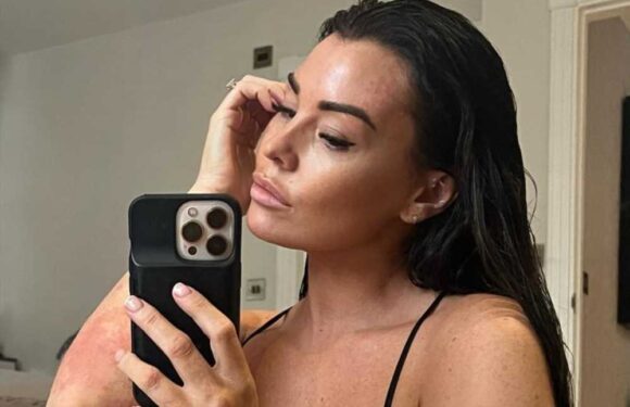 Jess Wright praised by Towie fans as she shows off ‘real skin’ in very honest post | The Sun