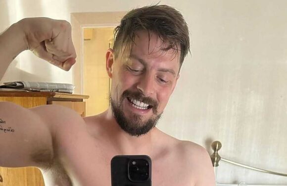 Love Island's Dr Alex shows off amazing weight loss as he celebrates a year sober | The Sun