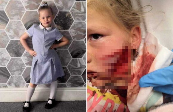 Our five-year-old daughter had her face 'ripped off' by a vicious American Bully – now we want the dog put down | The Sun