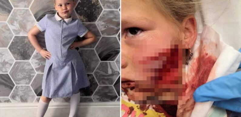 Our five-year-old daughter had her face 'ripped off' by a vicious American Bully – now we want the dog put down | The Sun
