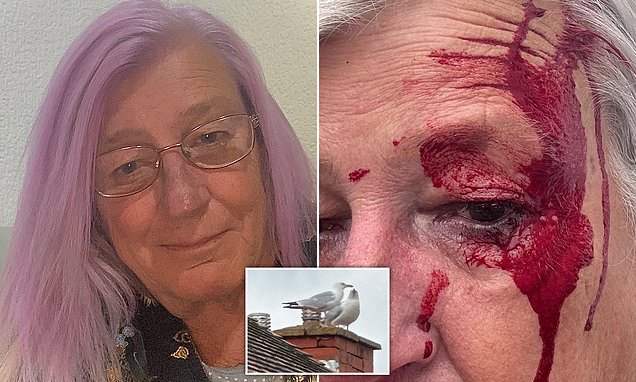 Pensioner left with blood pouring down her face after seagull attacked