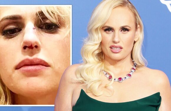 Rebel Wilson rushed to hospital after movie stunt goes wrong