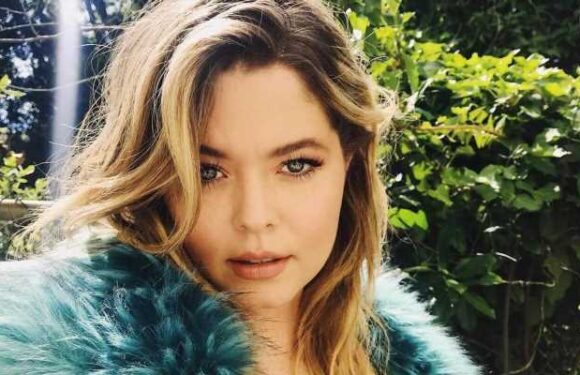 Sasha Pieterse Diagnosed With PCOS After Seeing Over 15 Gynecologists
