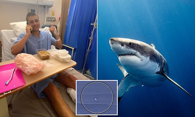 Surfer's astonishing tale of survival after great white shark