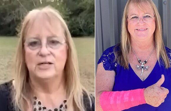 Texas woman is viciously attacked by snake AND hawk