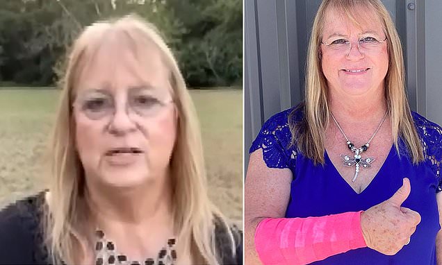 Texas woman is viciously attacked by snake AND hawk