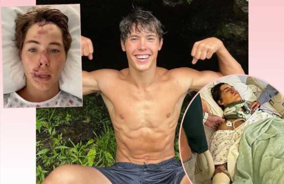 TikTok Star Caleb Coffee In ICU After Falling From ‘60 To 80-Foot’ Cliff In Hawaii