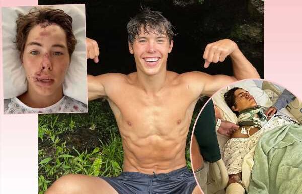 TikTok Star Caleb Coffee In ICU After Falling From ‘60 To 80-Foot’ Cliff In Hawaii