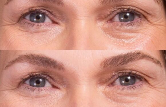 Beauty lovers say Trinny London product is better than Botox