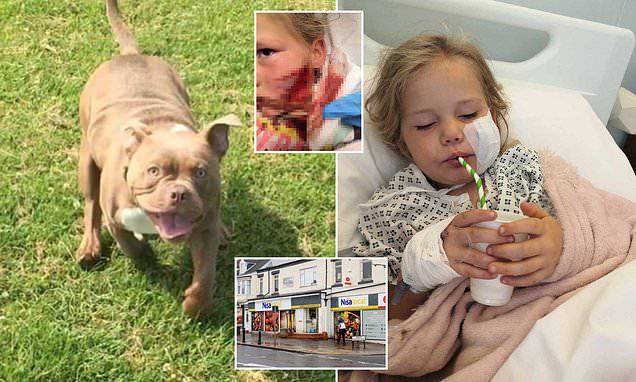 Bully that 'ripped off' part of five-year-old's cheek will be put down