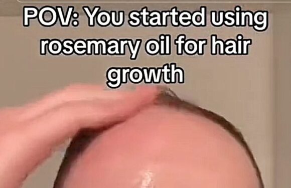 Can rubbing rosemary oil into your scalp really stop you going bald?