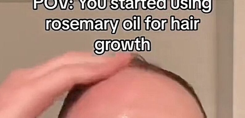 Can rubbing rosemary oil into your scalp really stop you going bald?