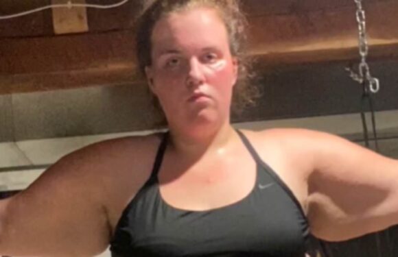 Doctors said I needed surgery to lose weight – I lost 150lbs naturally