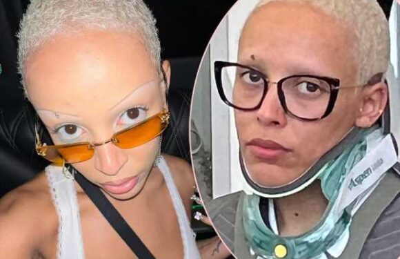 Doja Cat Responds To Concerned Fans After Posting Photo Of Herself In A NECK BRACE!