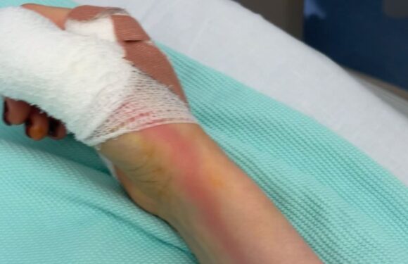 I almost died from sepsis after I scratching myself on a bowling ball