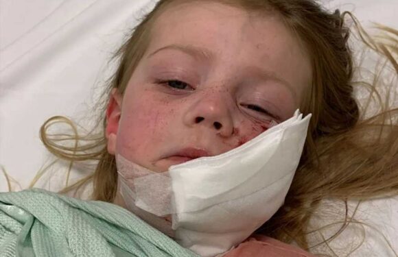 I fought an 80lb monster XL bully off my four-year-old daughter as he tore her face apart – she’s lucky to be alive | The Sun