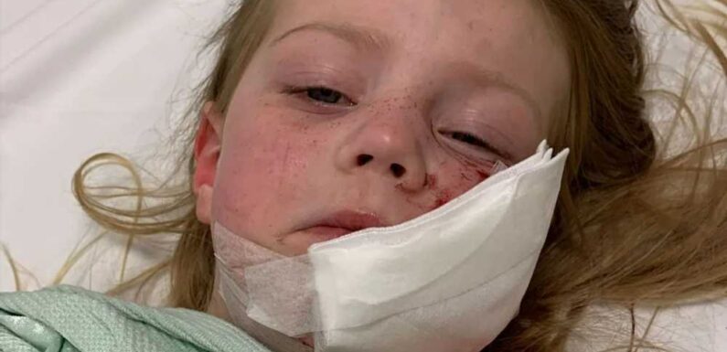 I fought an 80lb monster XL bully off my four-year-old daughter as he tore her face apart – she’s lucky to be alive | The Sun