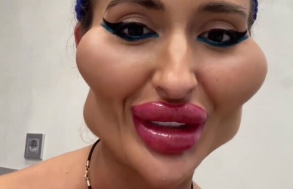‘I have the world’s biggest cheeks – I love them and don’t care what people say’