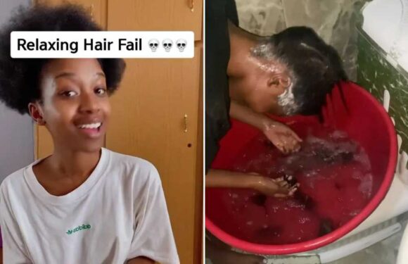 I tried to relax my own hair at home and it was an absolute nightmare – it fell out in clumps, and now I have a buzzcut | The Sun