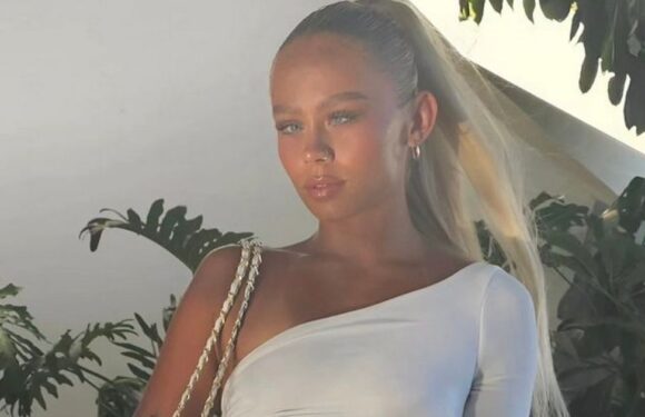 ‘I’m a model who’s spending £4,000 to fix my lazy eye before I lose my sight’