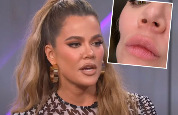 Khloé Kardashian Reveals How She's Dealing With Severe Cheek Indentation Left By Skin Cancer Surgery! LOOK!