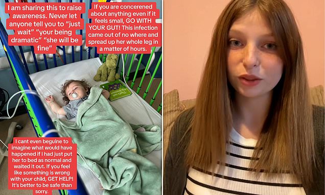 Mother's warning to others after baby daughter suffered spider bite