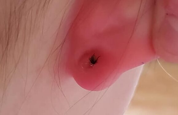 Mum's urgent warning after shocking discovery on her daughter's ear