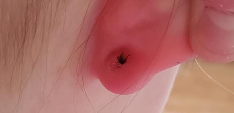 Mum's urgent warning after shocking discovery on her daughter's ear
