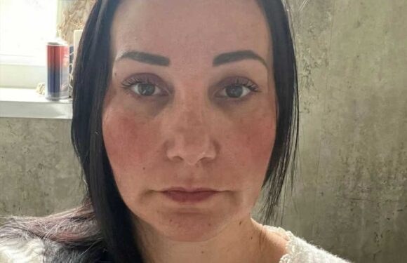 My chest muscles ripped in half and rolled up to my neck after botched £7,000 boob job – it felt like being hit by a bus | The Sun