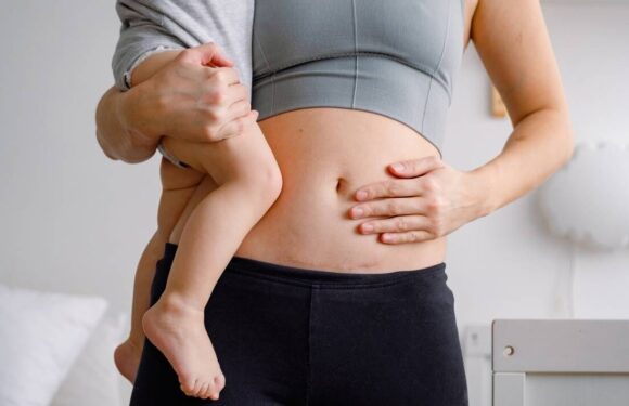 ‘My husband went on a golf trip three weeks after my C-section’