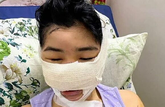 Rapist 'cuts off his ex-wife's nose and ears in horrific attack'