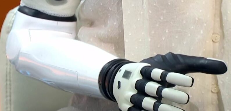 World's first AI BIONIC MUM, reveals what life is like with limb