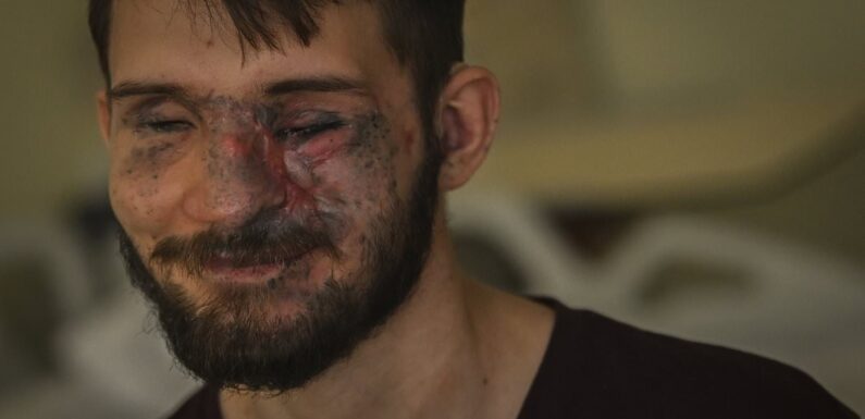 Wounded Ukraine soldier one of many undergoing psychological treatment
