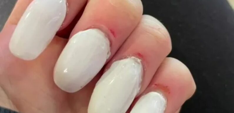 A nail tech spent four hours doing my basic white acrylics – they’re so bad, people say they look like Airpod cases | The Sun