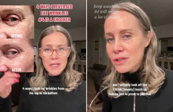 I’ve been reversing my wrinkles without Botox or injections and now I look 10 years younger | The Sun