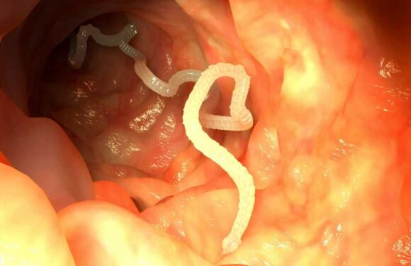 Man who deliberately ate tapeworms left fearing for his life after doctors’ stark warning | The Sun