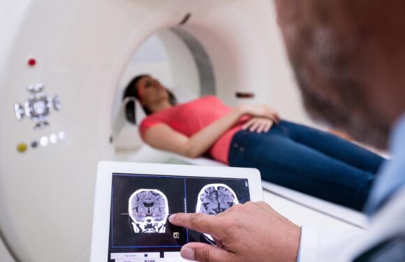 Patient waited 27 days to be admitted to stroke unit